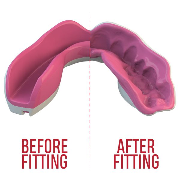 за Зъби SAFEJAWZ EXTRO SERIES SELF FIT PINK FANGZ MOUTHGUARD 6